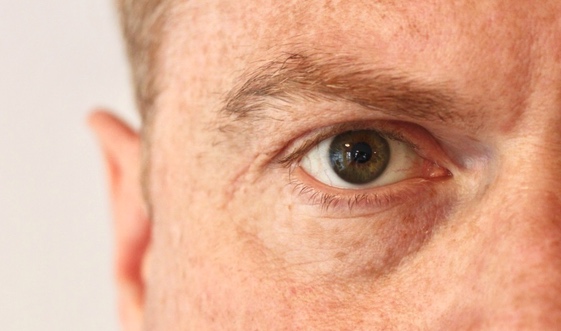 Augenarzt aus Neuss weist auf die fehlenden Studien zu einer Lasertherapie bei AMD hin. (Die Bildrechte liegen bei dem Verfasser der Mitteilung.)