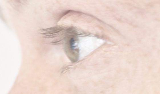 Bei trockenen Augen ist es wichtig, dies regelmäßig beim Augenarzt kontrollieren zu lassen. (Die Bildrechte liegen bei dem Verfasser der Mitteilung.)