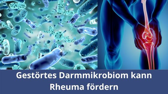 Gestörtes Darmmikrobiom kann Rheuma fördern (Die Bildrechte liegen bei dem Verfasser der Mitteilung.) Gestörtes Darmmikrobiom kann Rheuma fördern (Die Bildrechte liegen bei dem Verfasser der Mitteilung.)