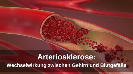 Arteriosklerose: Wechselwirkung zwischen Gehirn und Blutgefäße nachgewiesen (Die Bildrechte liegen bei dem Verfasser der Mitteilung.) Arteriosklerose: Wechselwirkung zwischen Gehirn und Blutgefäße nachgewiesen (Die Bildrechte liegen bei dem Verfasser der Mitteilung.)