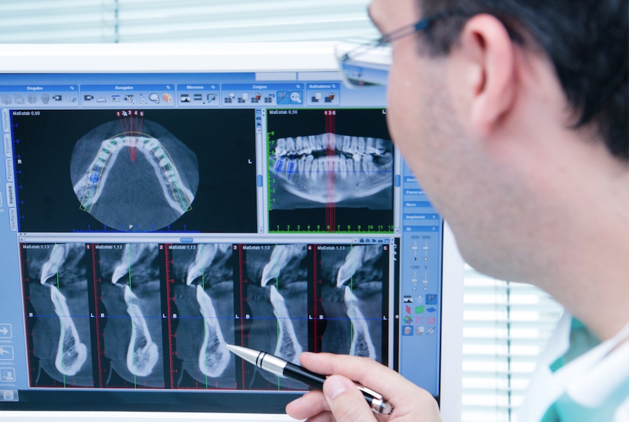 Hochauflösende Röntgenaufnahmen ermöglichen eine schnelle und genaue Diagnose©DENVITA (Die Bildrechte liegen bei dem Verfasser der Mitteilung.) Hochauflösende Röntgenaufnahmen ermöglichen eine schnelle und genaue Diagnose©DENVITA (Die Bildrechte liegen bei dem Verfasser der Mitteilung.)