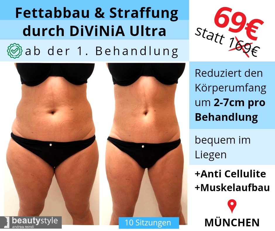 Abnehmerfolg nach 10 Divinia Behandlungen (Die Bildrechte liegen bei dem Verfasser der Mitteilung.) Abnehmerfolg nach 10 Divinia Behandlungen (Die Bildrechte liegen bei dem Verfasser der Mitteilung.)