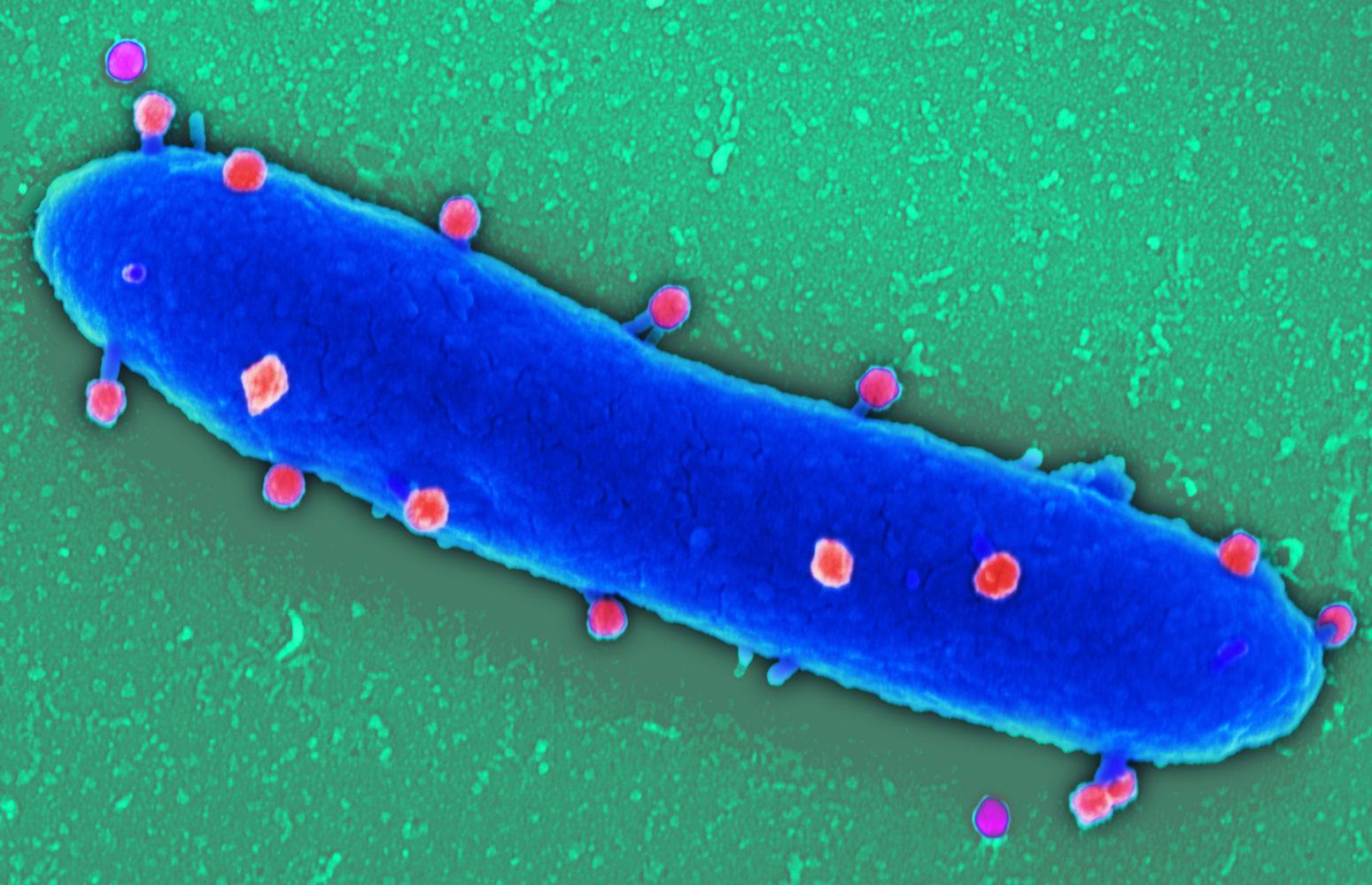 Phagen (rot) angedockt an eine Pseudomonas aeruginosa (blau) (Die Bildrechte liegen bei dem Verfasser der Mitteilung.)