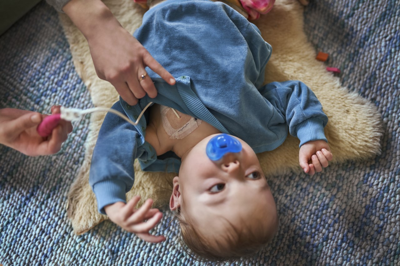 Kampagnenbild Wombly - Baby mit Kurzdarmsyndrom und zentralem Venenkatheter (Die Bildrechte liegen bei dem Verfasser der Mitteilung.) Kampagnenbild Wombly - Baby mit Kurzdarmsyndrom und zentralem Venenkatheter (Die Bildrechte liegen bei dem Verfasser der Mitteilung.)