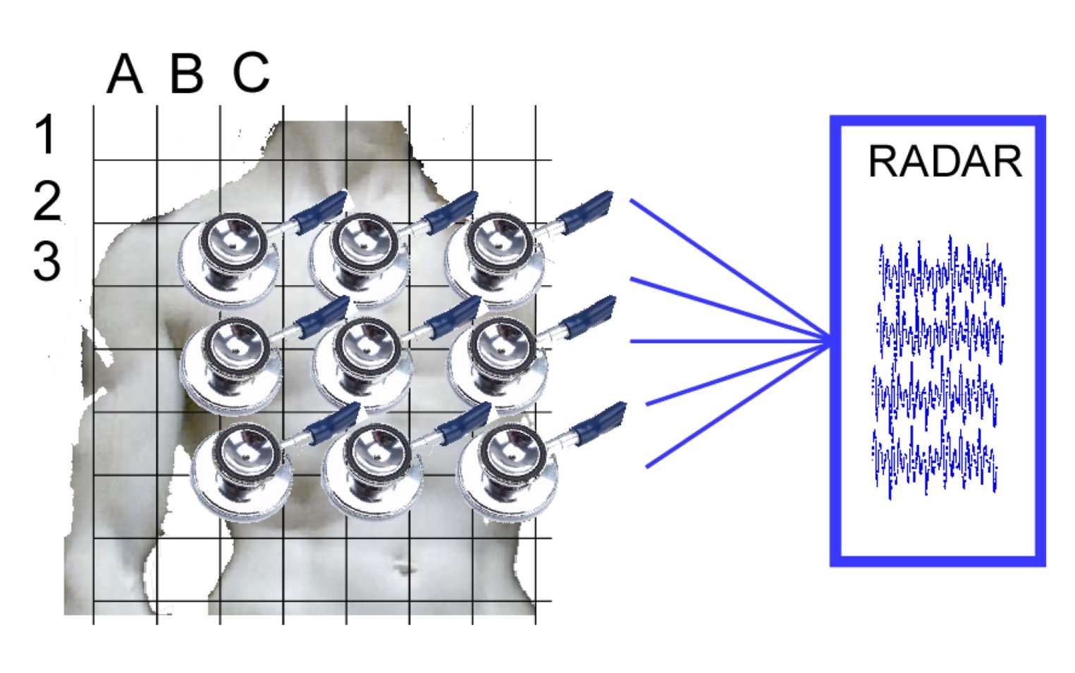 smart analytics: Im Projekt 3D RADAR Scanner wird ein berührungsloser Scanner entwickelt (Bildquelle: ADBInno SARL) smart analytics: Im Projekt 3D RADAR Scanner wird ein berührungsloser Scanner entwickelt (Bildquelle: ADBInno SARL)