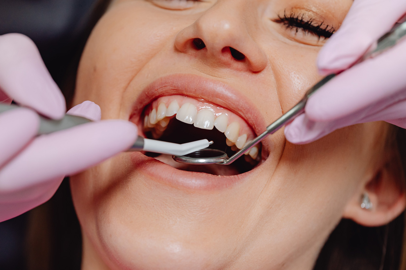 Dentale Weichgeweberegeneration Dentale Weichgeweberegeneration
