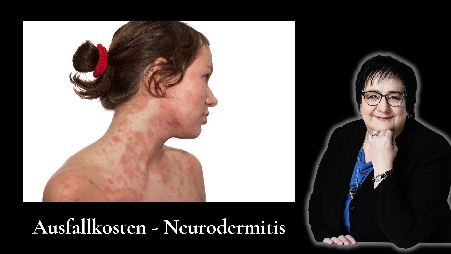 Ausfallkosten durch Neurodermitis (Die Bildrechte liegen bei dem Verfasser der Mitteilung.) Ausfallkosten durch Neurodermitis (Die Bildrechte liegen bei dem Verfasser der Mitteilung.)