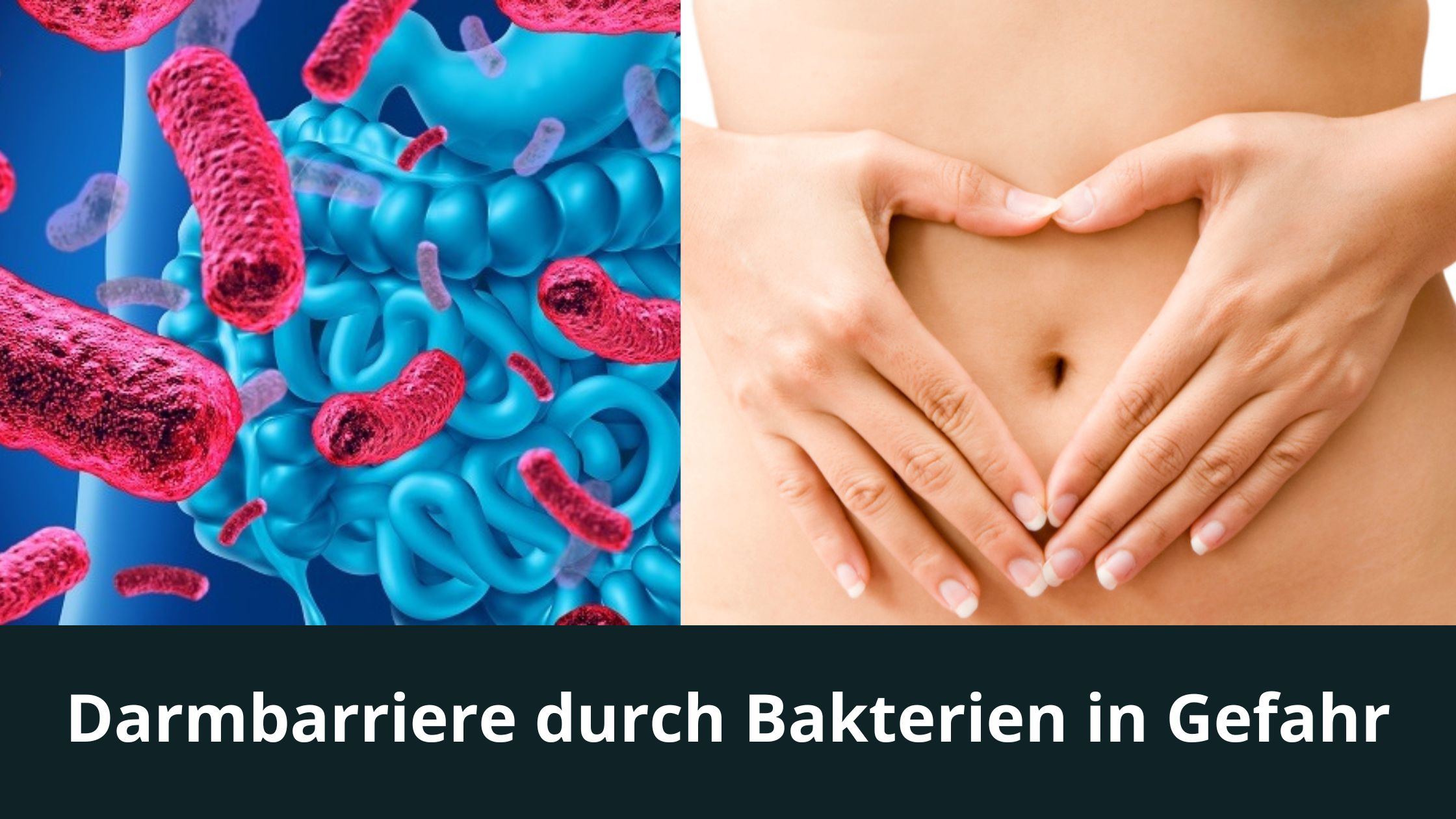 Darmbarriere durch Bakterien in Gefahr / Redaktion bioresonanz-zukunft.de (Die Bildrechte liegen bei dem Verfasser der Mitteilung.) Darmbarriere durch Bakterien in Gefahr / Redaktion bioresonanz-zukunft.de (Die Bildrechte liegen bei dem Verfasser der Mitteilung.)