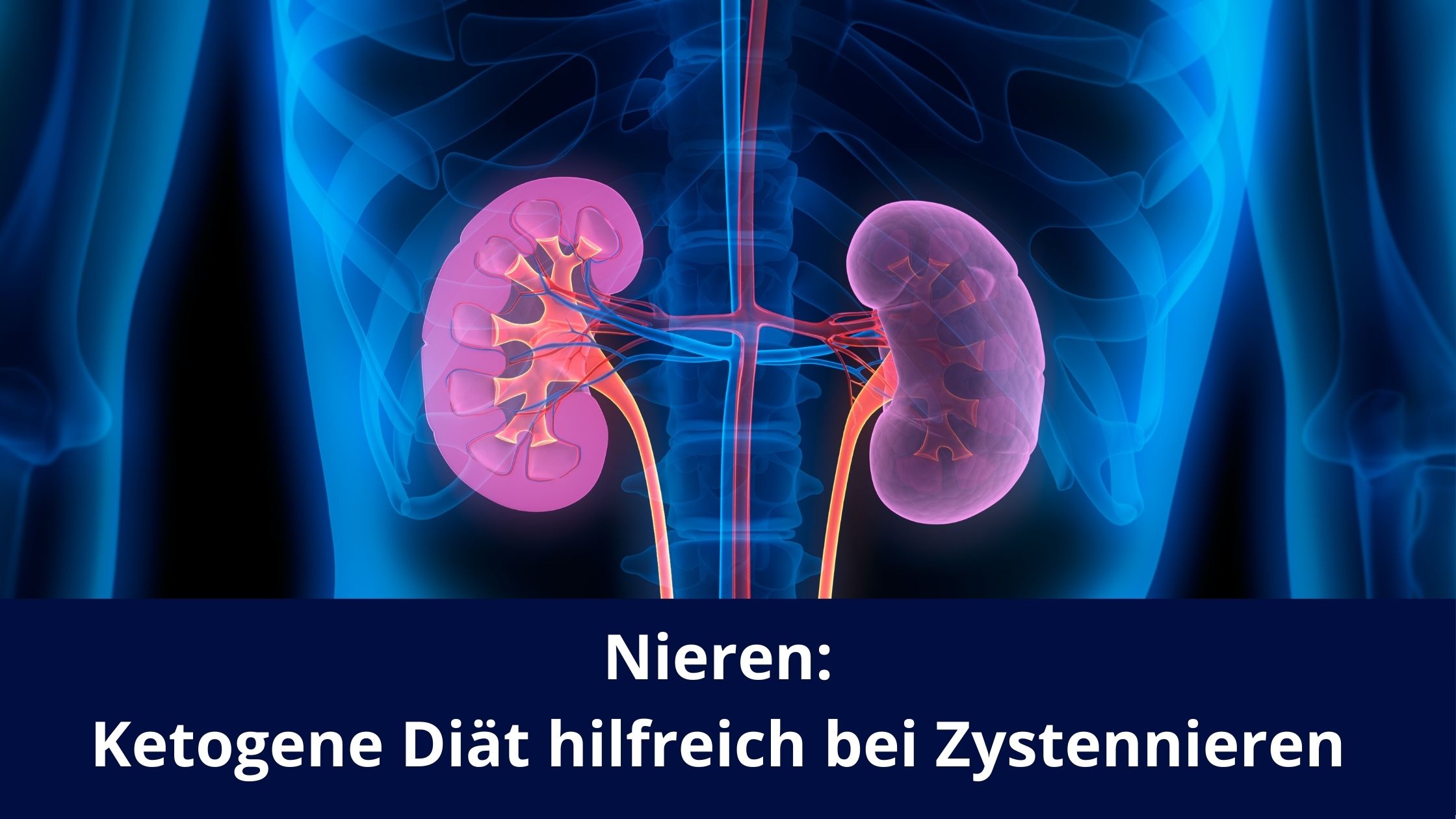 Nieren: Ketogene Diät hilfreich bei Zystennieren / Redaktion bioresonanz-zukunft.de (Die Bildrechte liegen bei dem Verfasser der Mitteilung.)