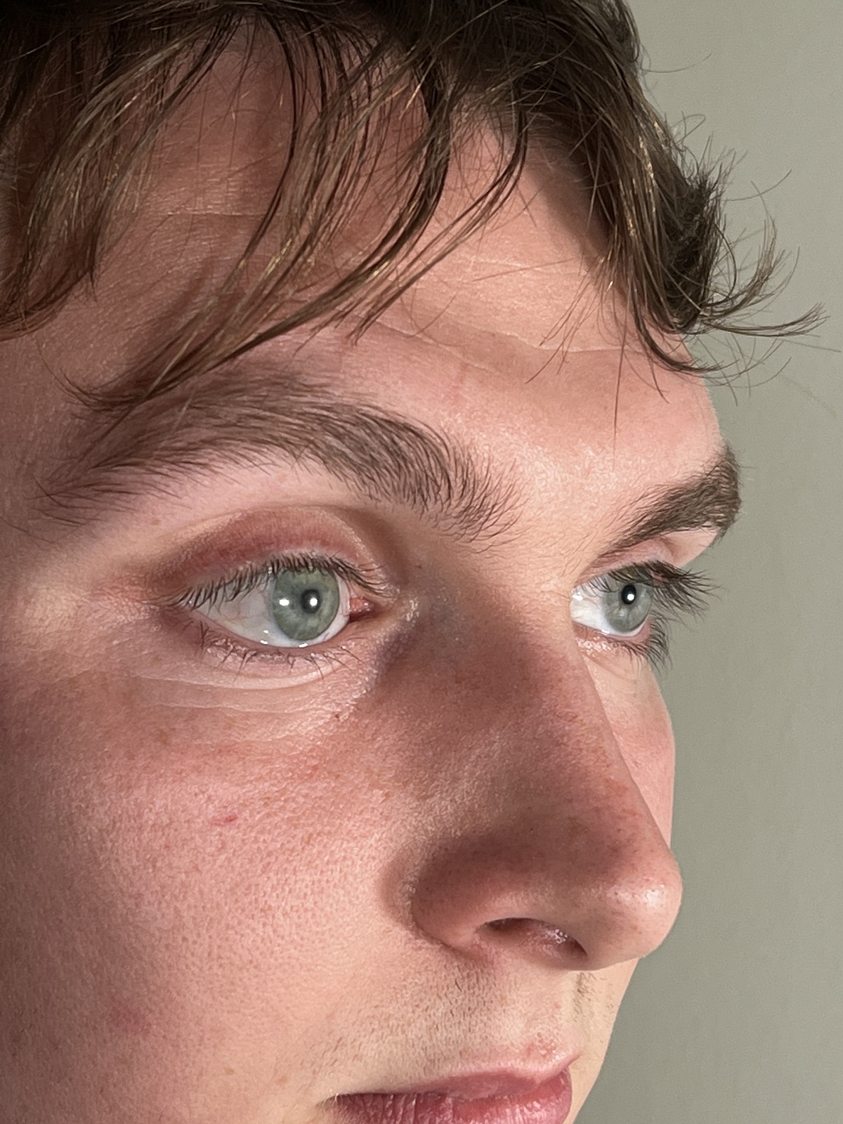 Fraunhofer IGD 3D-Druckverfahren - Das künstliche rechte Auge, im Bild links zu sehen Fraunhofer IGD 3D-Druckverfahren - Das künstliche rechte Auge, im Bild links zu sehen