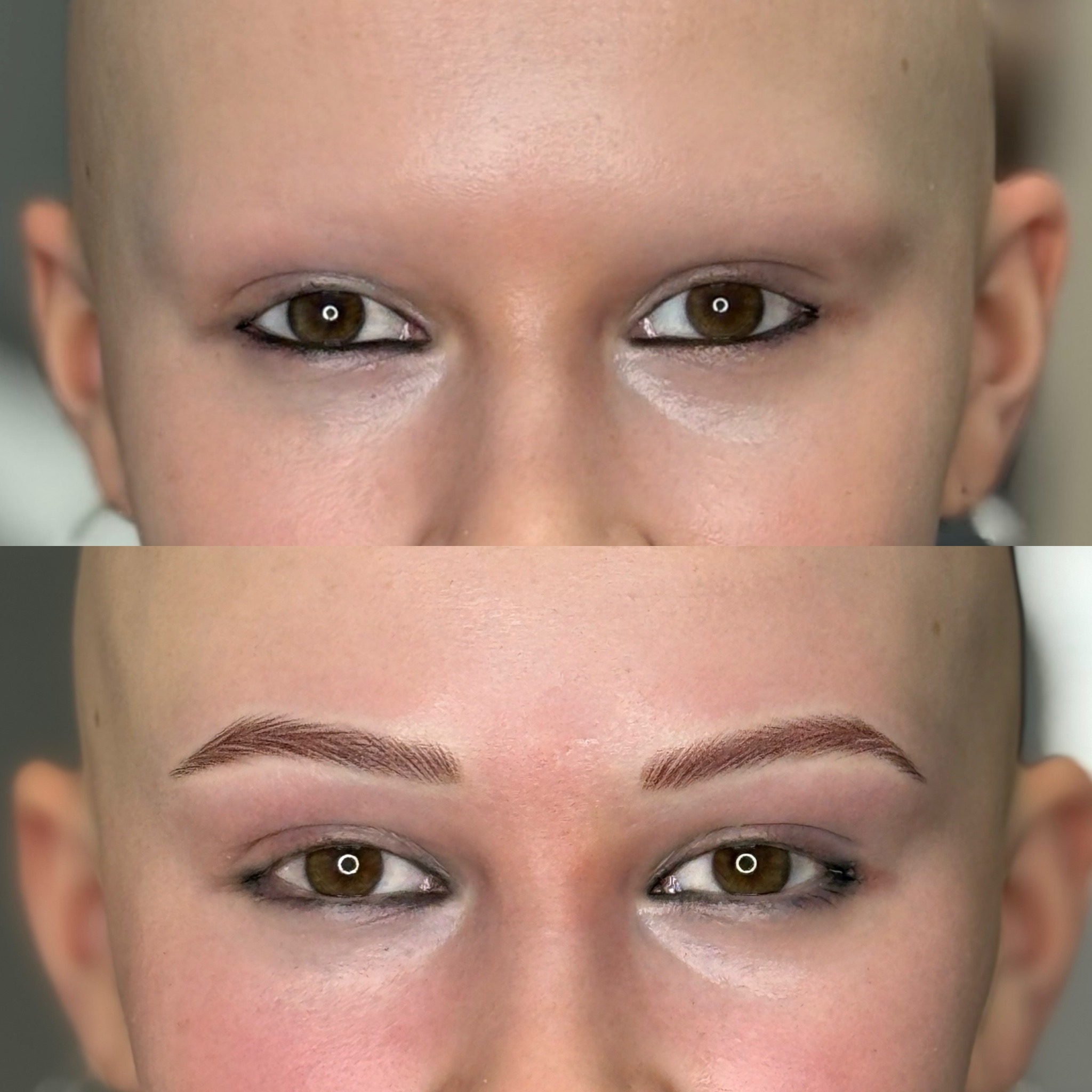 Jugendliche mit Alopezie - vorher und nach Permanent Make Up Behandlung (Die Bildrechte liegen bei dem Verfasser der Mitteilung.) Jugendliche mit Alopezie - vorher und nach Permanent Make Up Behandlung (Die Bildrechte liegen bei dem Verfasser der Mitteilung.)