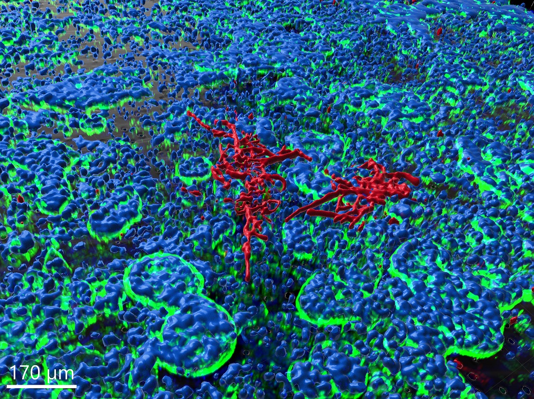 3D-Rekonstruktionen der Epithelzellschicht des Darms mit C. albicans (Fluoreszenzaufnahme) (Bildquelle:©Raquel Alonso-Roman, Parastoo Akbarimoghaddam) 3D-Rekonstruktionen der Epithelzellschicht des Darms mit C. albicans (Fluoreszenzaufnahme) (Bildquelle:©Raquel Alonso-Roman, Parastoo Akbarimoghaddam)