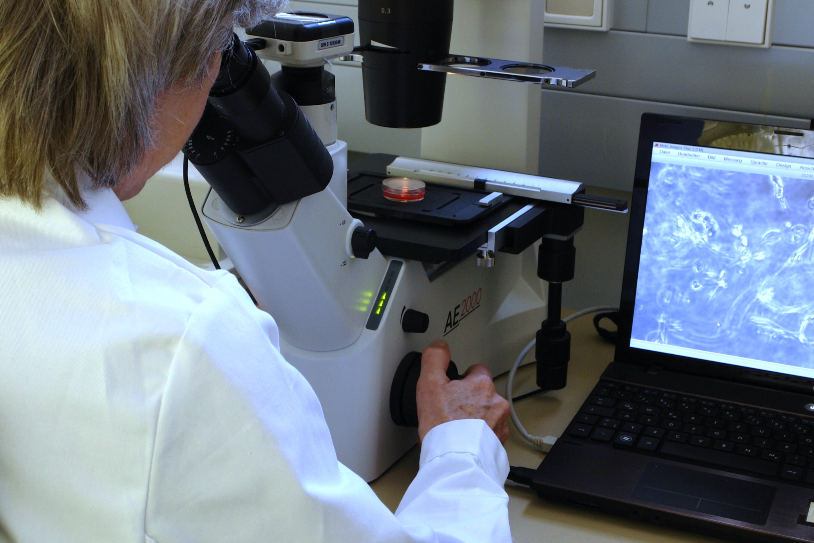 Mikroskopische Analyse der 3D Kultur von Fibroblasten in lichtinduziertem Hydrogel (Bildquelle: Cellendes GmbH) Mikroskopische Analyse der 3D Kultur von Fibroblasten in lichtinduziertem Hydrogel (Bildquelle: Cellendes GmbH)