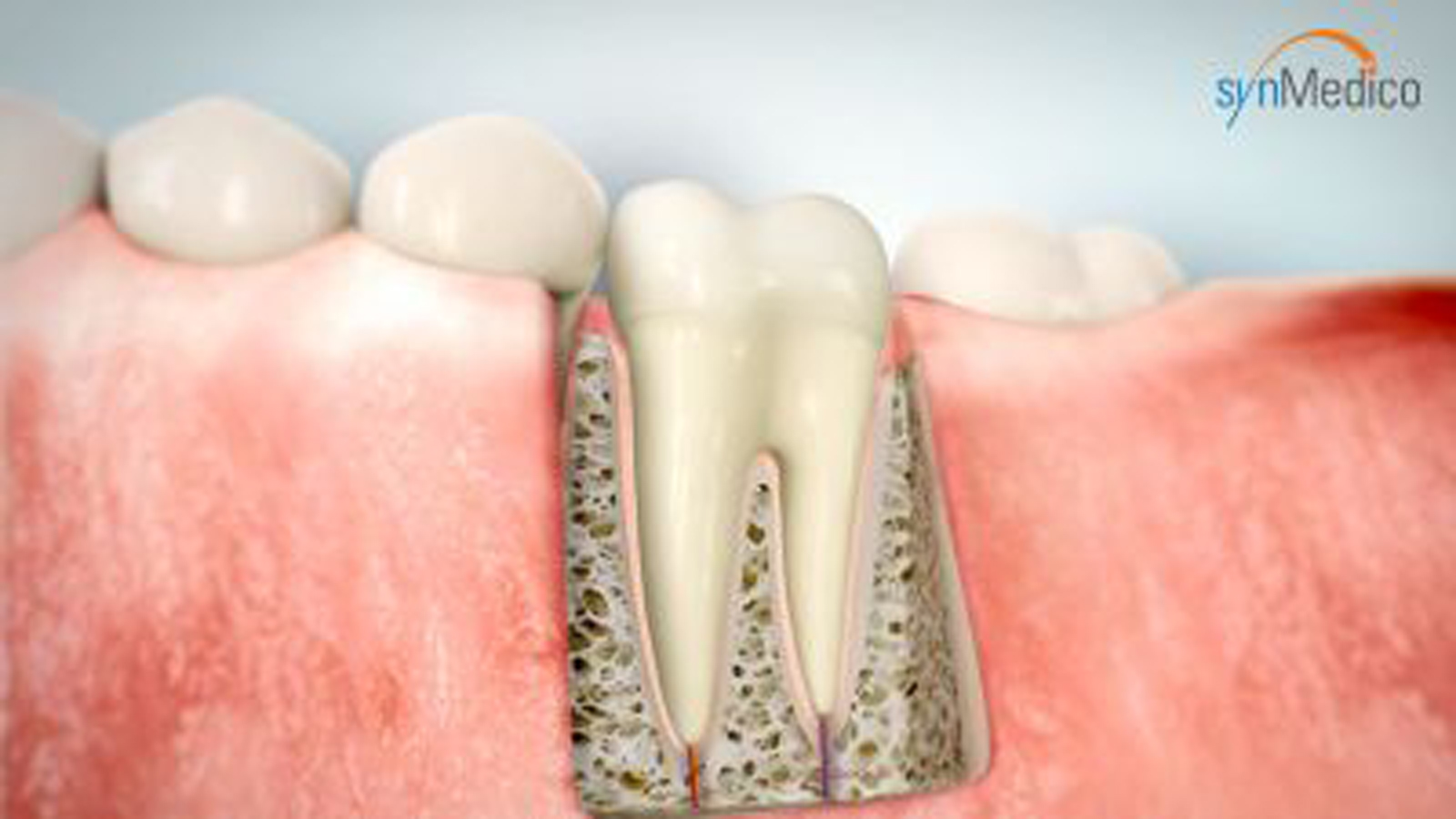 Endodontie - Wurzelbehandlung - Zahnklinik Saarland Endodontie - Wurzelbehandlung - Zahnklinik Saarland
