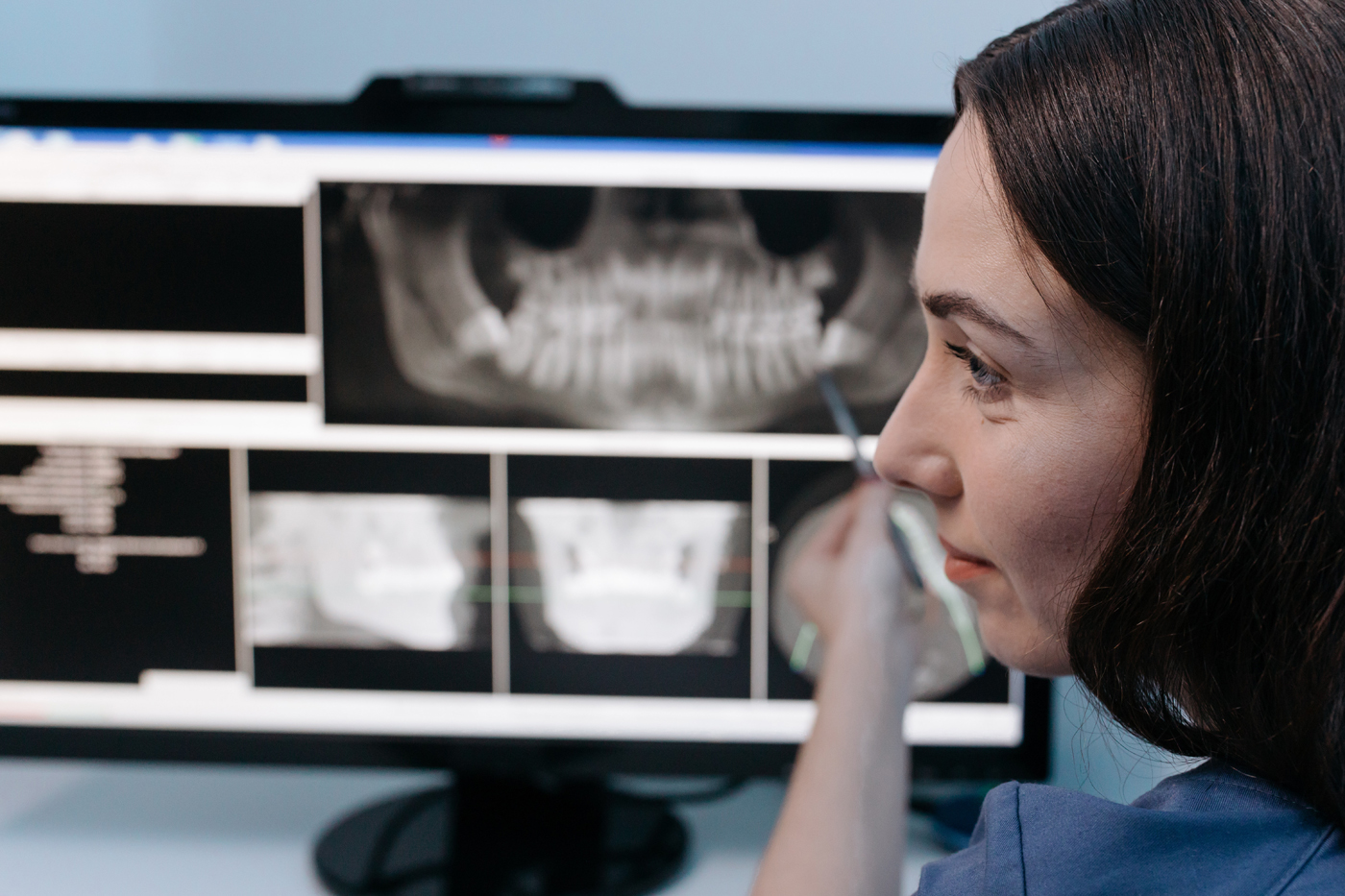 Knochenaufbau vor einer Implantation - Augmentation Knochenaufbau vor einer Implantation - Augmentation