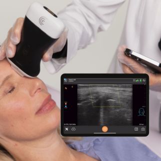 Filler millimetergenau korrigieren: Hylase& Ultraschall (Die Bildrechte liegen bei dem Verfasser der Mitteilung.)