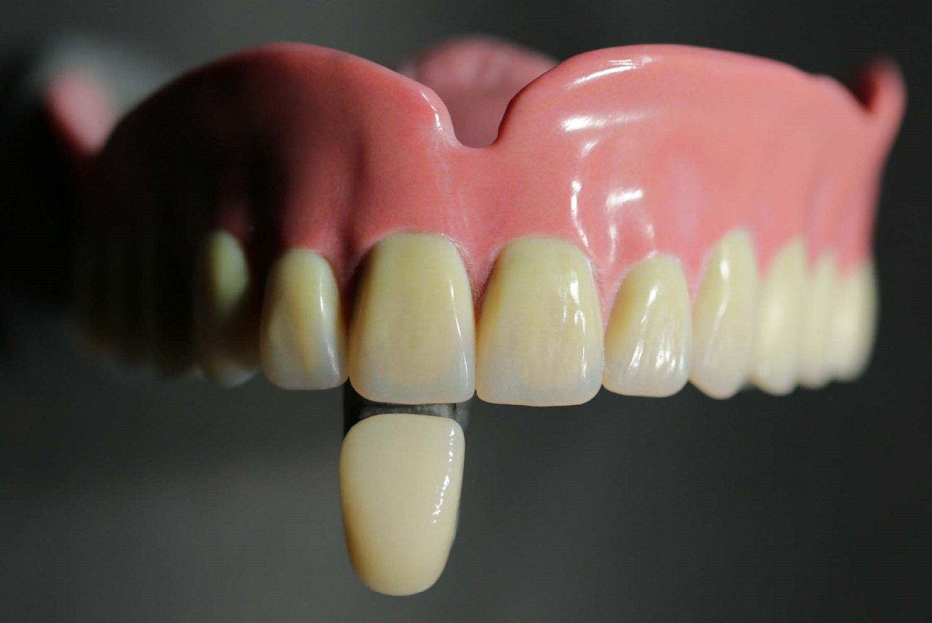 Fraunhofer IGD - Monolithische Zahnprothese aus dem 3D-Drucker