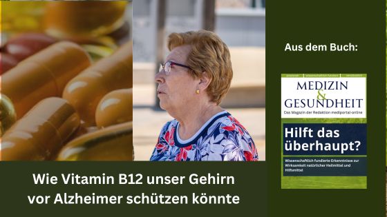 Wie Vitamin B12 unser Gehirn vor Alzheimer schützen könnte (Die Bildrechte liegen bei dem Verfasser der Mitteilung.)
