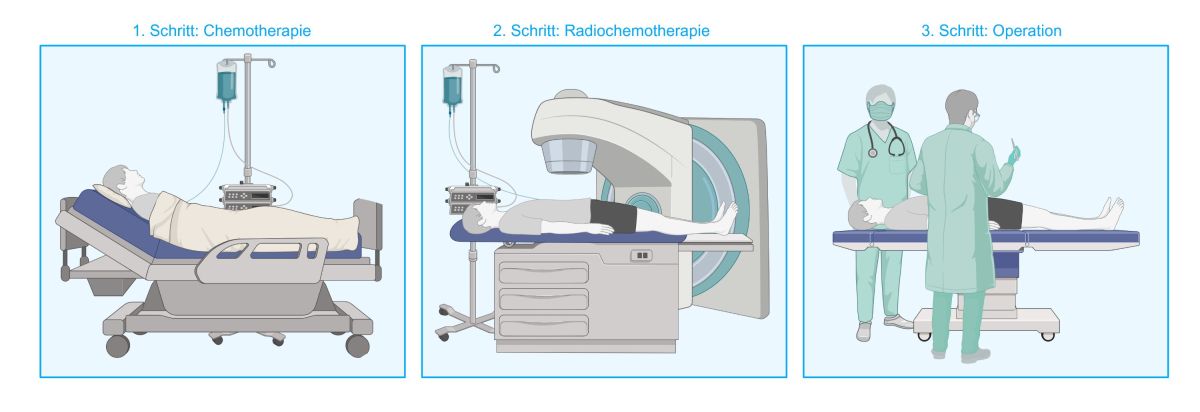 Deutsche Krebshilfe leistet umfassende Forschungsförderung (© Deutsche Krebshilfe / Erstellt mit biorender.com)