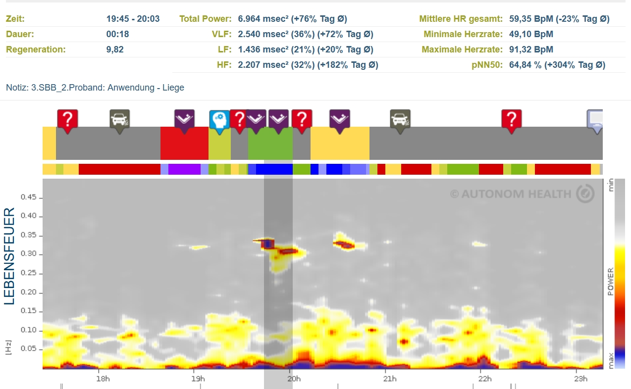 Fig. 1 Heart rate variability measurement during a Subtle Body Balance treatment (Bildquelle: Autonom Health)