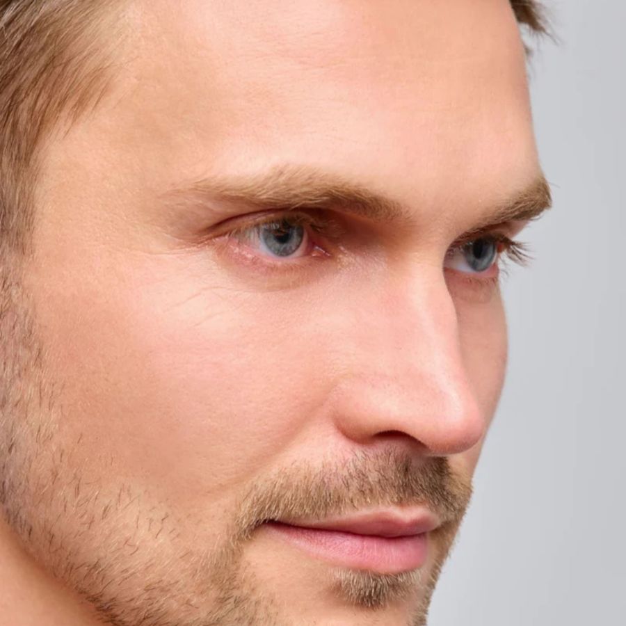 Unterlidstraffung (© )