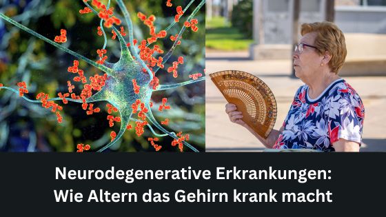 Neurodegenerative Erkrankungen: Wie Altern das Gehirn krank macht (Die Bildrechte liegen bei dem Verfasser der Mitteilung.)