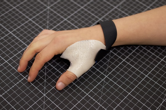 Ergotherapie unterstützt die Beweglichkeit von Hand und Fingern. (Die Bildrechte liegen bei dem Verfasser der Mitteilung.)