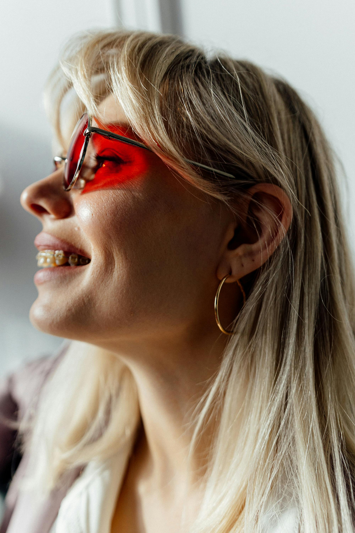 Überbiss, Hyperdontie und Mesidosens