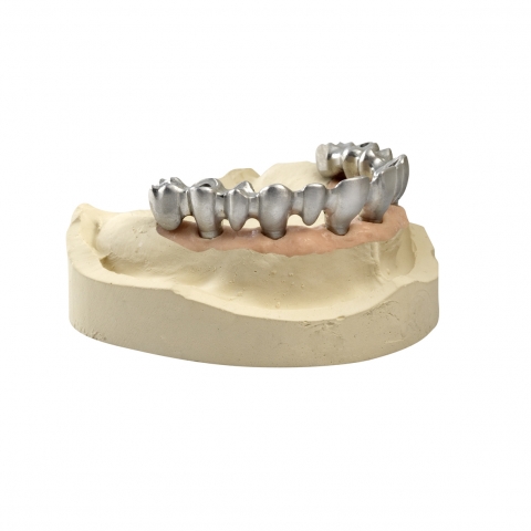 VON KOPF BIS FUSS AUF IMPLANTATE EINGESTELLT VON KOPF BIS FUSS AUF IMPLANTATE EINGESTELLT