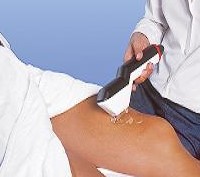 Dauerhafte Haarentfernung bei BellaDerma in Berlin Dauerhafte Haarentfernung bei BellaDerma in Berlin