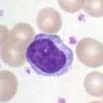 Lymphozyt Lymphozyt