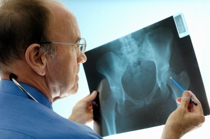 Bauchfett bei Frauen ist ein Risiko für Osteoporose