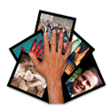Jahresergebnis Wiederherstellung der Dermis der Hand nach schweren Brandverletzungen Jahresergebnis Wiederherstellung der Dermis der Hand nach schweren Brandverletzungen
