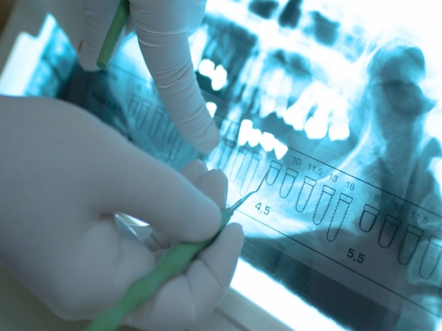 140.000 Implantate pro Jahr heilen nicht ein - Oralchirurgie ist gefordert 140.000 Implantate pro Jahr heilen nicht ein - Oralchirurgie ist gefordert