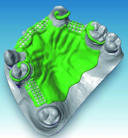 CADSTAR SETZT JETZT AUCH IM DIGITALEN MODELLGUSS NEUE MASSSTÄBE CADSTAR SETZT JETZT AUCH IM DIGITALEN MODELLGUSS NEUE MASSSTÄBE