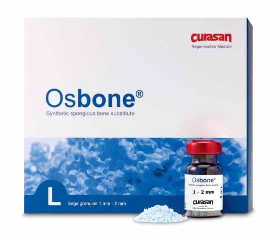 Osbone® - IDS bestätigt internationales Interesse an synthetischem Hydroxylapatit made in Germany Osbone® - IDS bestätigt internationales Interesse an synthetischem Hydroxylapatit made in Germany