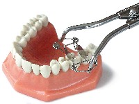 Neue Matrizen- und Kofferdamklammerzange von WALSER®/Foto: Dr. Walser Dental GmbH Neue Matrizen- und Kofferdamklammerzange von WALSER®/Foto: Dr. Walser Dental GmbH