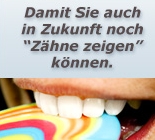 Zahnschutzvergleich auf young-insurance.de