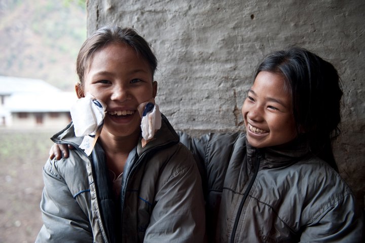 Nach der Operation: Nepalese hat das Augenlicht zurückgewonnen. Nach der Operation: Nepalese hat das Augenlicht zurückgewonnen.