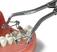 Walser Matrizen Zange/Foto: Dr. Walser Dental GmbH Walser Matrizen Zange/Foto: Dr. Walser Dental GmbH