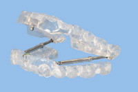 Mit sleeplus zurück zu gesundem Schlaf – die Protrusionsschiene Mit sleeplus zurück zu gesundem Schlaf – die Protrusionsschiene