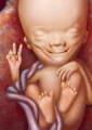 Fetus Fetus