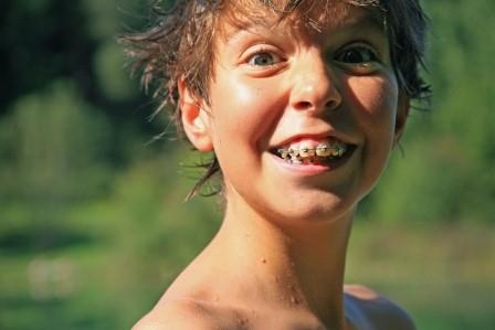 Die Zahnzusatzversicherung mit dem Baustein Kieferorthopädie: Wichtig für Kinder Die Zahnzusatzversicherung mit dem Baustein Kieferorthopädie: Wichtig für Kinder
