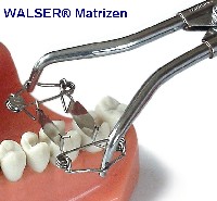 Walser Matrizensystem/Foto: Dr. Walser Dental GmbH Walser Matrizensystem/Foto: Dr. Walser Dental GmbH