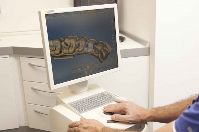 Anwendung der CEREC-Software zur perfekten Nachbildung von Zähnen durch Dr. Thomas Jung