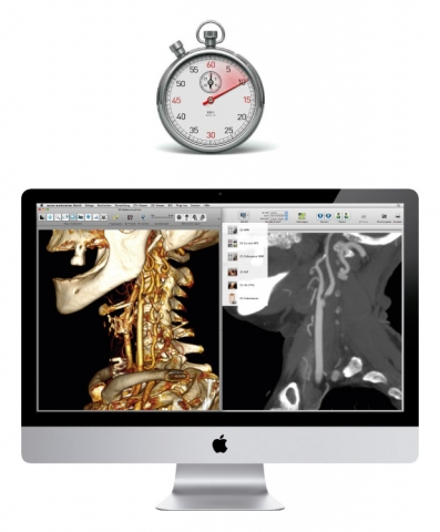aycan workstation OsiriX PRO beim Face-Off aycan workstation OsiriX PRO beim Face-Off