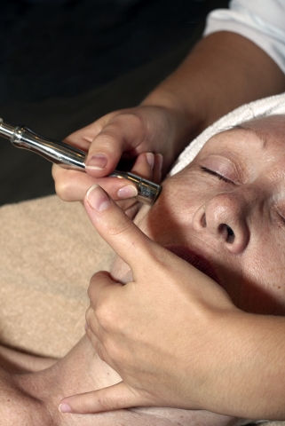Microdermabrasion Microdermabrasion