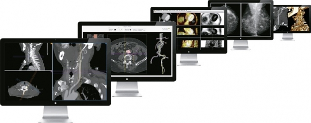 aycan OsiriX PRO? Die Highspeed-Workstation für Routine- und Spezialaufgaben. aycan OsiriX PRO? Die Highspeed-Workstation für Routine- und Spezialaufgaben.