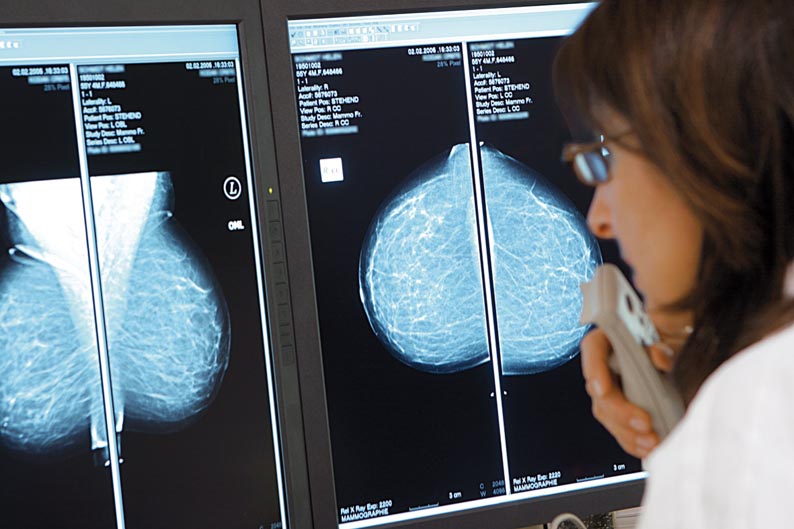 Kooperationsgemeinschaft Mammographie Kooperationsgemeinschaft Mammographie