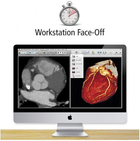 aycan OsiriX PRO am Face-Off? Darstellung von Cardio-CT in 2D und 3D aycan OsiriX PRO am Face-Off? Darstellung von Cardio-CT in 2D und 3D